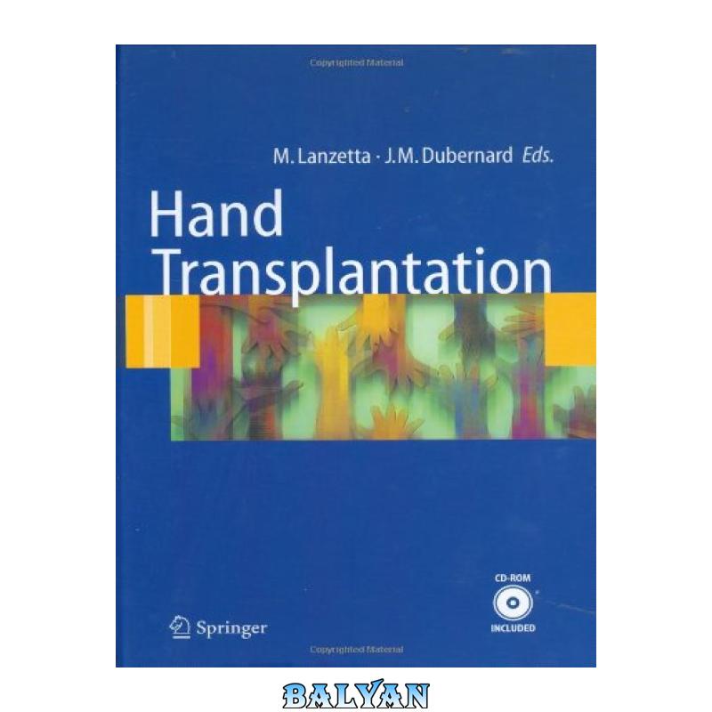 Hand Surgery
