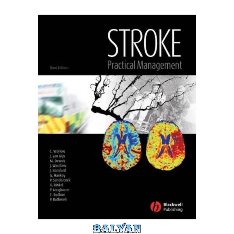 Stroke: Practical Management