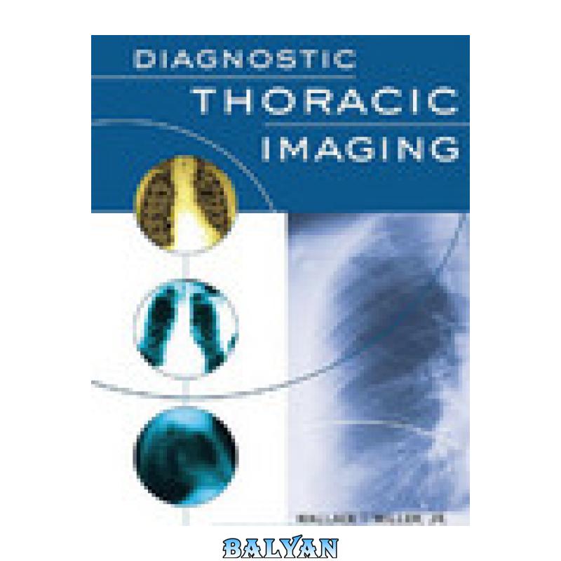 9acc8a13691cc808e970577f3d1917e8.jpg دانلود کتاب Diagnostic Thoracic Imaging - تصویر 1